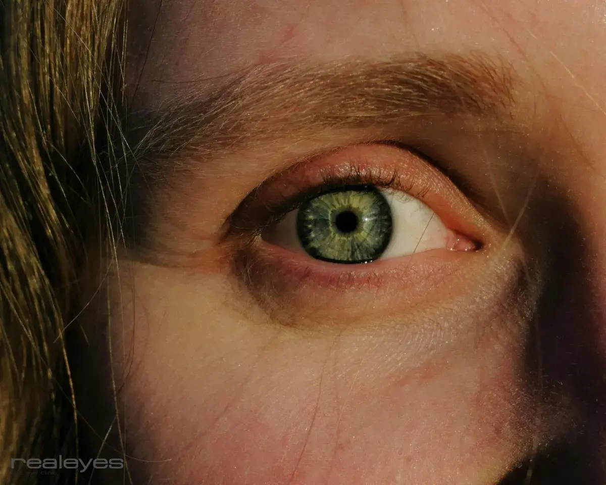 Tired eyes
